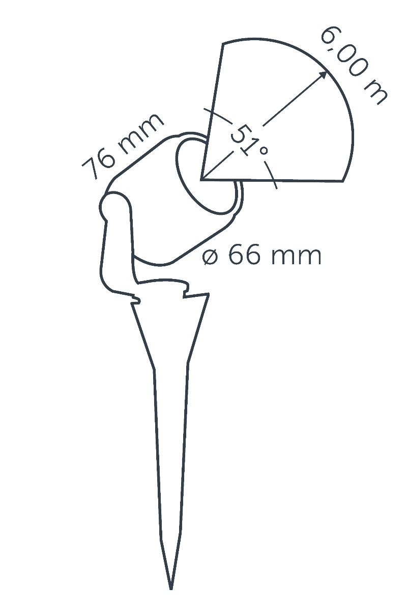 in-lite Big Scope - technical drawing with dimensions
